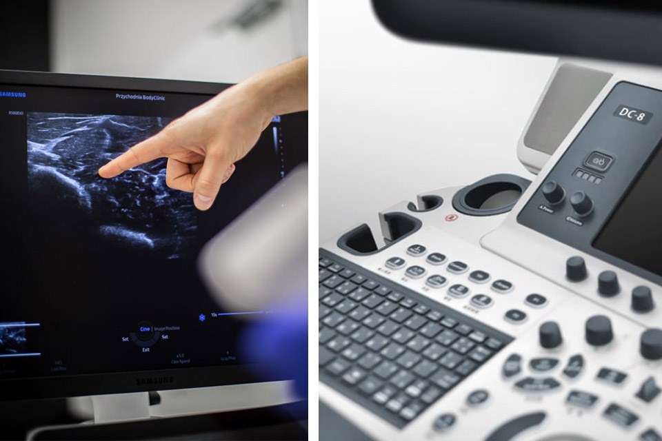 Lekarz wskazuje zmianę na obrazie USG oraz aparat Mindray DC-8 w pracowni BodyClinic